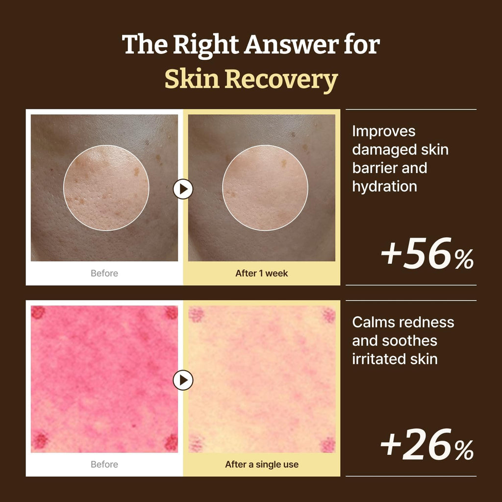 Dr. Reju-All Advanced PDRN Rejuvenating Cream - 99% Pure Salmon DNA PDRN Face Moisturizer - Korean Skin Care Face Cream - 20ml