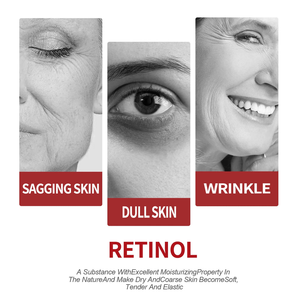 Retinol Moisture Cream Reduce Wrinkles Dark Under-Eye Circles.