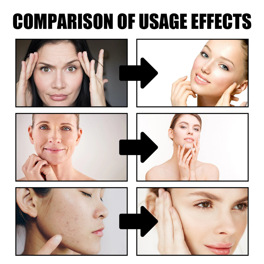 Face Cream Dragon Blood Pore Shrinking Facial Rejuvenation Nourishing cream.